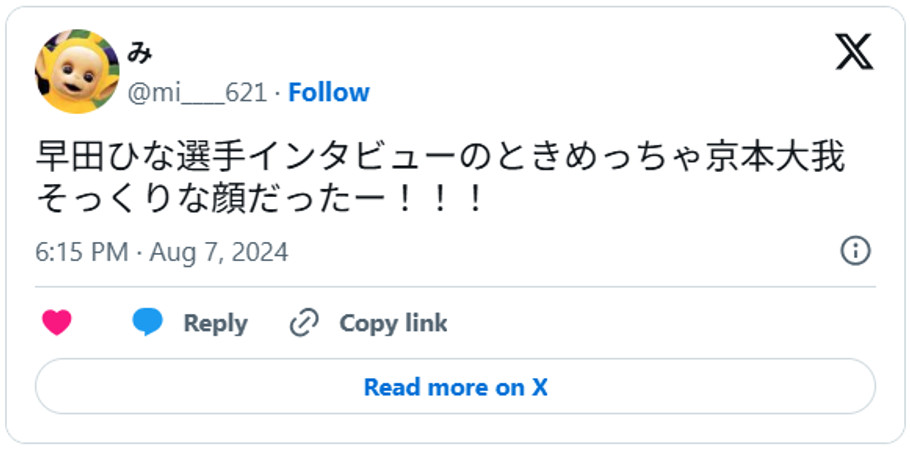 早田ひな選手インタビューのときめっちゃ京本大我そっくりな顔だったー!!!August 7, 2024 (引用:Xより)