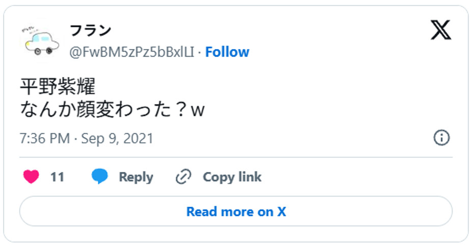 平野紫耀、なんか顔変わった？w　 September 9, 2021(引用：Ｘより)